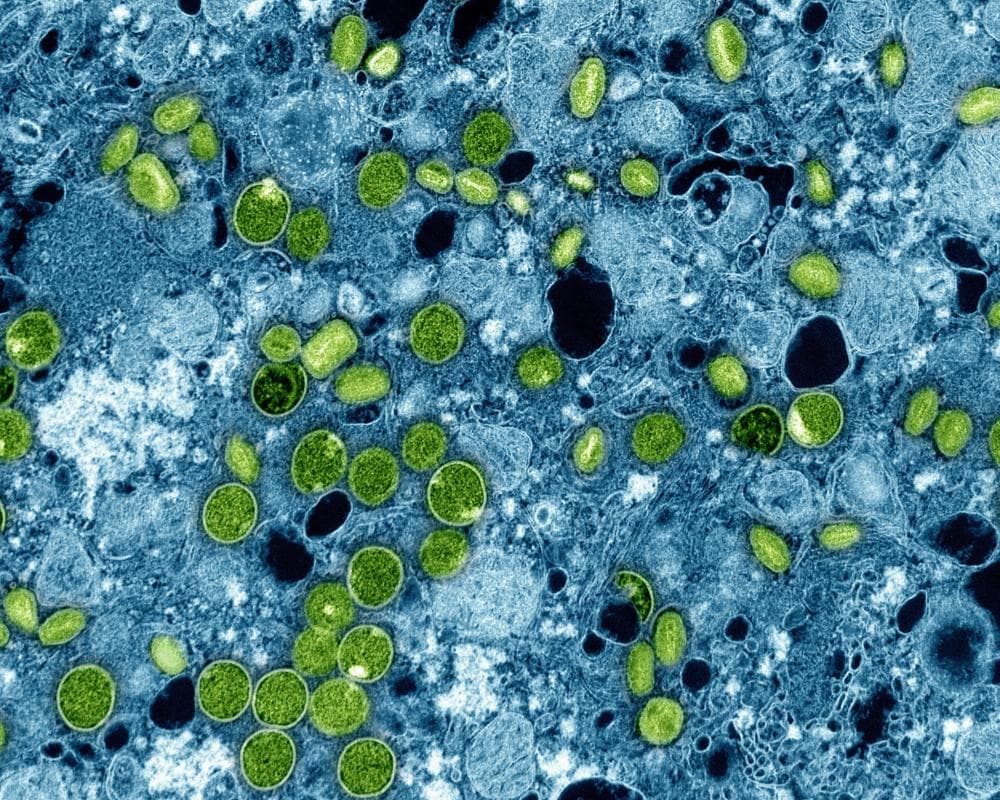 The image of the article.